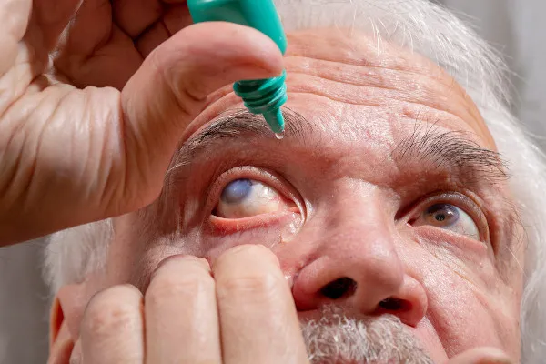 Desigualdade no diagnóstico de glaucoma: crescimento de exames no SUS exige ações mais eficientes de acesso