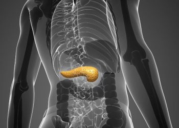 Câncer de pâncreas: o inimigo oculto que ataca em silêncio