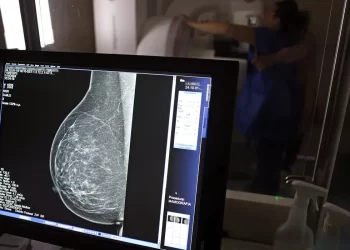 SUS amplia acesso à mamografia e introduz novas medidas no combate ao câncer de mama