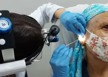 Cera de ouvido: o novo aliado na detecção precoce do câncer